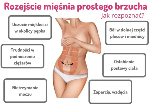 Zanik mięśni objawy: Jak rozpoznać i uniknąć groźnych skutków