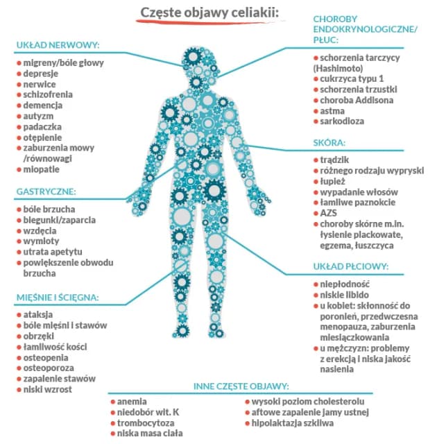 Alergia na gluten objawy – poznaj niebezpieczne sygnały organizmu Alergia na gluten objawy – poznaj niebezpieczne sygnały organizmu